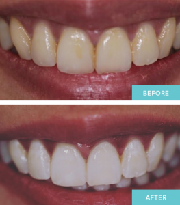 DentiVive